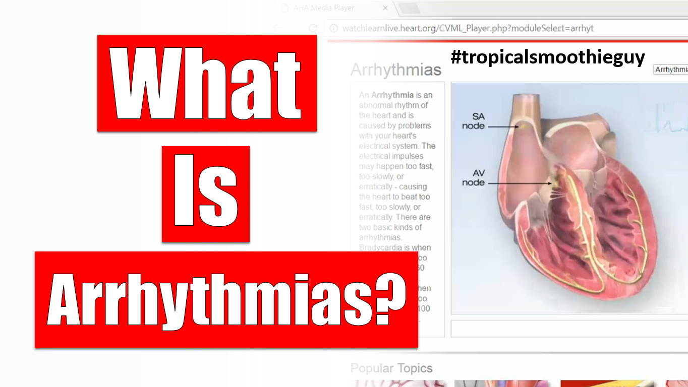 arrhythmias