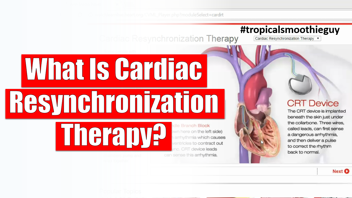 Cardiac Resynchronization Therapy