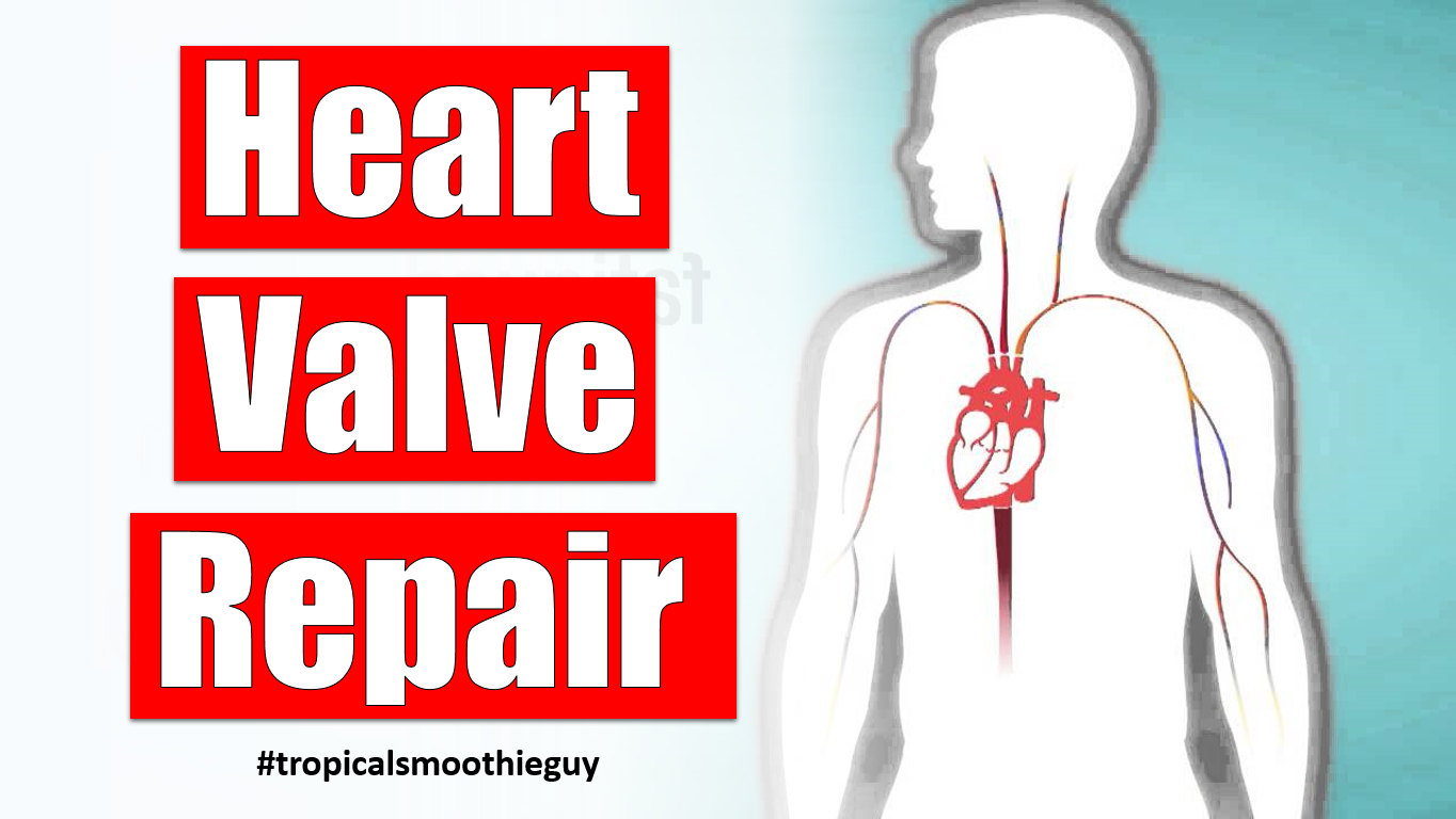 Heart Valve Repair