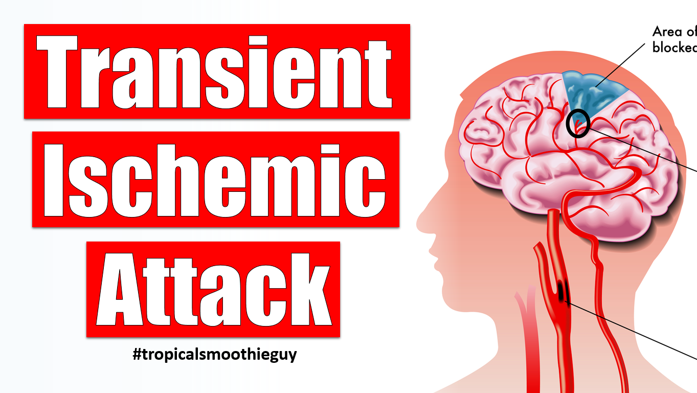 how-a-transient-ischemic-attack-affects-your-brain